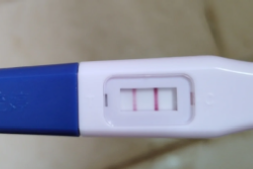 宝宝睡眠抽动是正常现象吗？江苏助孕专家解答