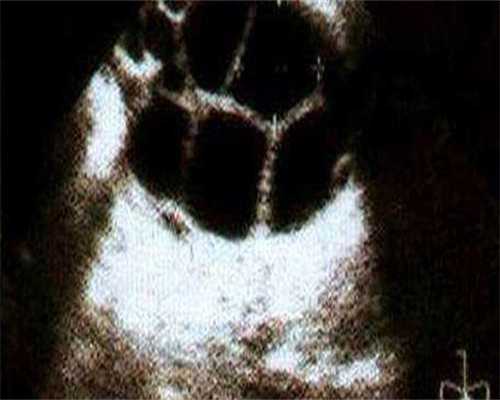 宿迁三代试管条件解读：南京辅助生殖技术解析