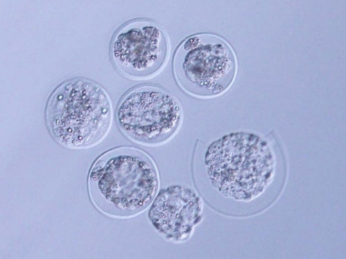 连云港进行辅助生殖的理想年龄与医院选择指南