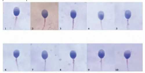 江苏儿童湿疹皮炎的科学调理指南