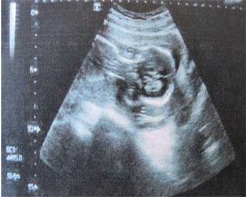 江苏宝宝呕吐如何处理