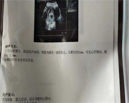 四个月江苏宝宝消化不良?破解拉奶瓣难题