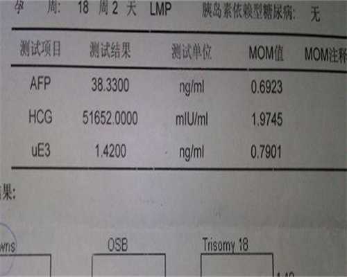 奶阵频繁吸奶困难？别担心，助孕新思路助您轻松育儿！