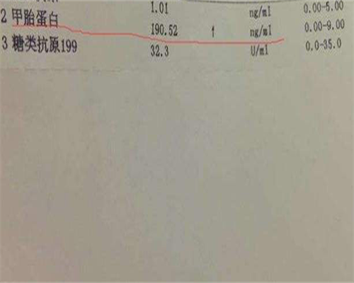 江苏助孕宝宝如何成功摆脱夜奶困扰？