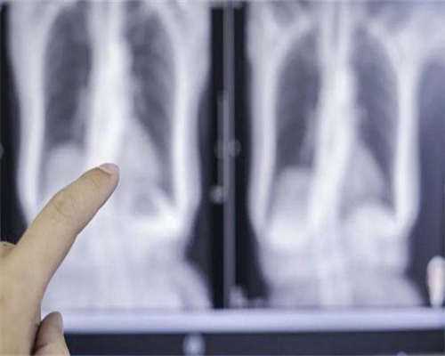 帮江苏助孕宝宝购买保险有窍门